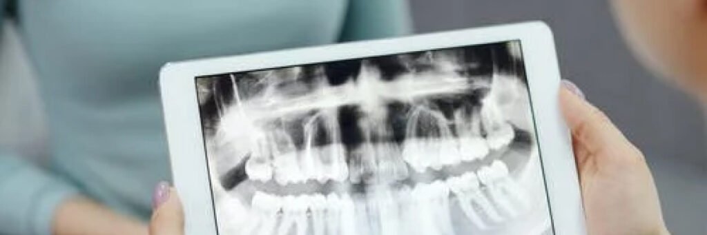 Dental crowns prior to treatment