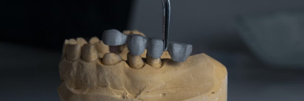 Tooth crown, dental crowns
